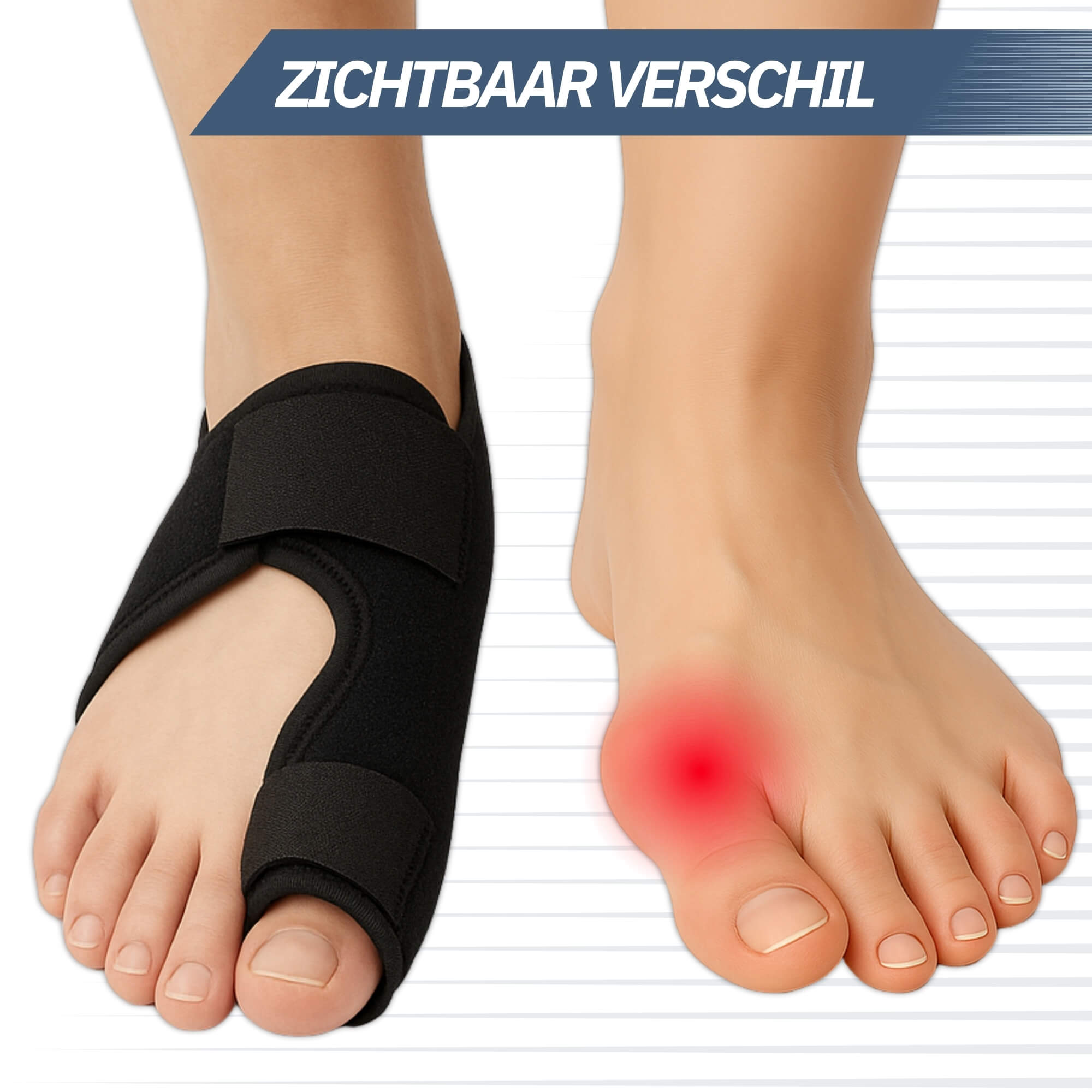 Trebin Hallux Valgus Teencorrector – Set van 2, One Size, Zwart