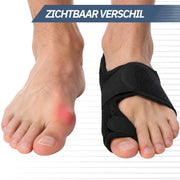 Hallux Valgus Teencorrector met Spalk – Set van 2